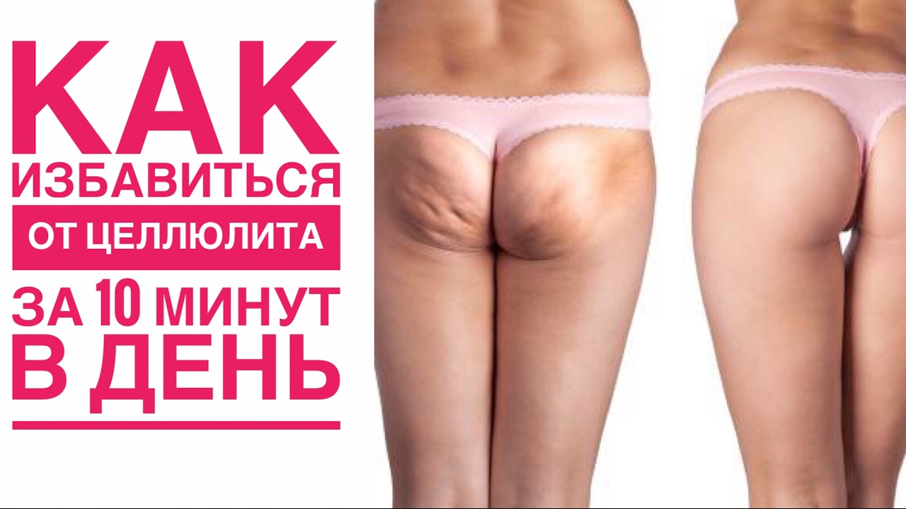 Пляжный сезон без целлюлита